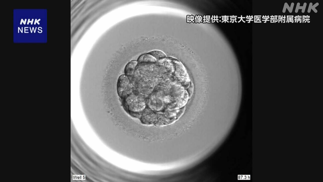 不妊治療-aiで卵子の数など予測するモデルを開発-東大など-|-nhk